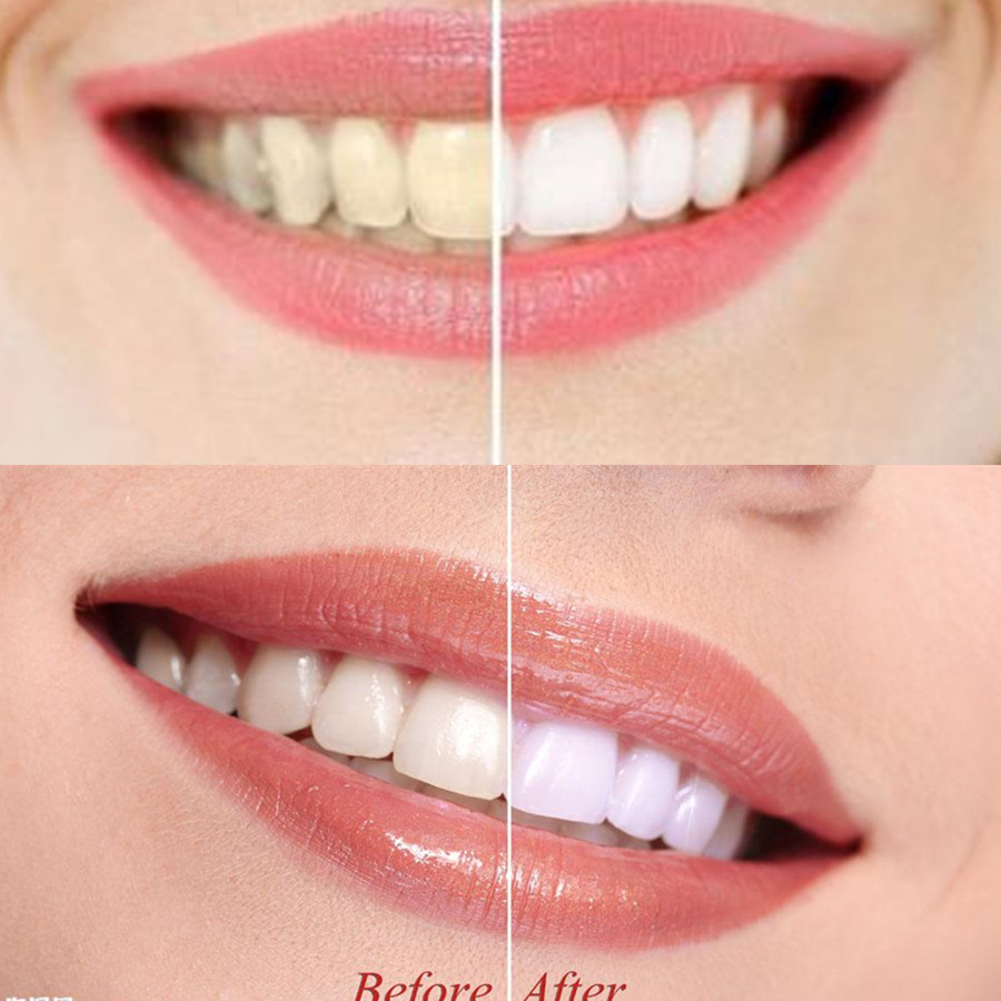 Bamboo Charcoal Teeth Tooth De - Teeth Whitening Price ulasan dan harga