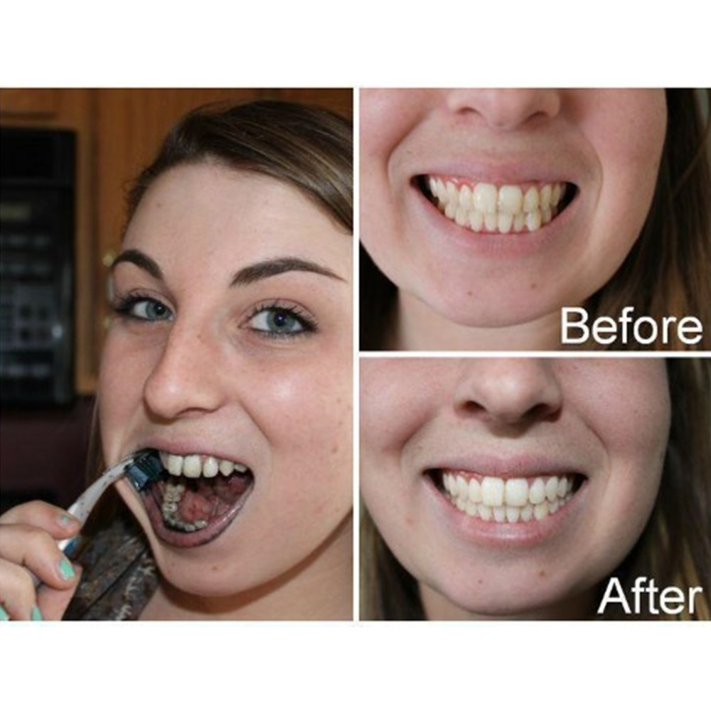 Bamboo Charcoal Teeth Tooth De - Teeth Whitening Price ulasan dan harga