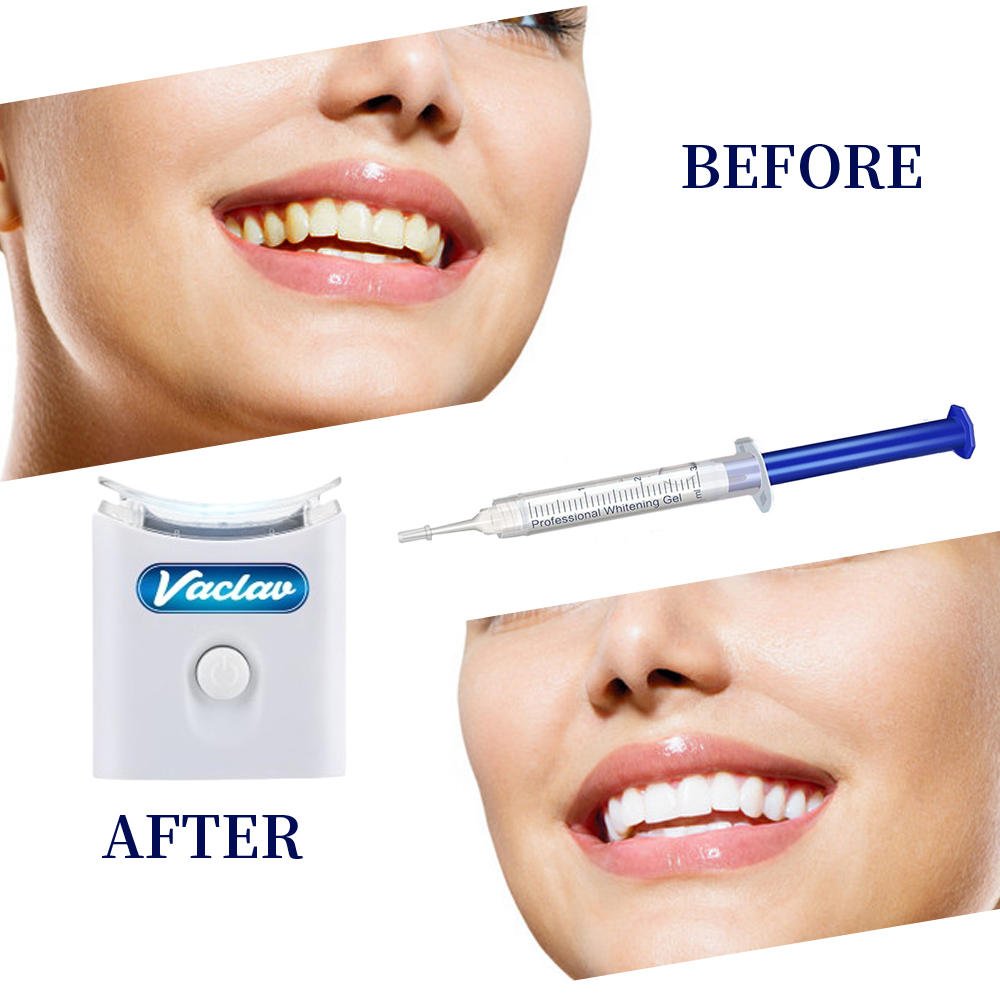 Mint Teeth Whitening Gel Syrin - Teeth Whitening Kit At Home ulasan dan harga