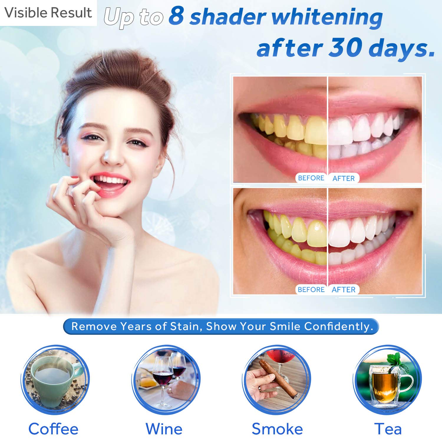 Teeth Whitening Gel Refill Syr - Teeth Whitening Price ulasan dan harga