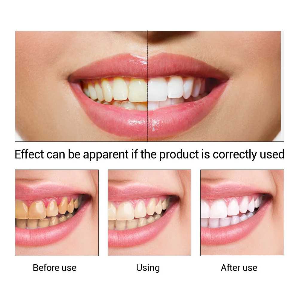 FTEENPLY Teeth Whitening Essen - Teeth Whitening Cream ulasan dan harga