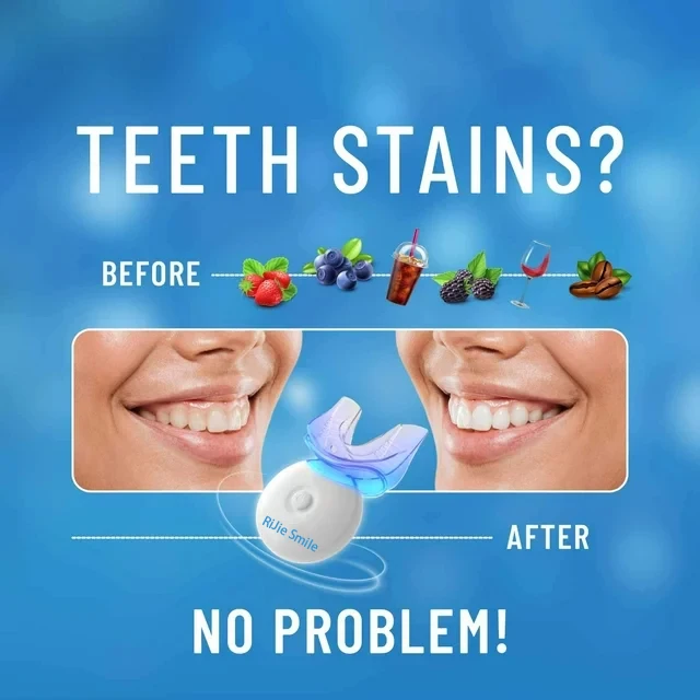 High Quality Cleaning Kit Wire - Teeth Whitening Kit At Home ulasan dan harga