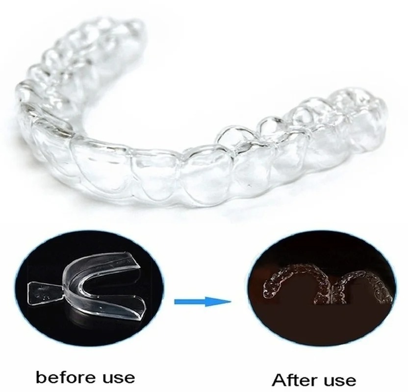 Anti Snoring Bruxism Sleeping  - Teeth Whitening Retainer ulasan dan harga