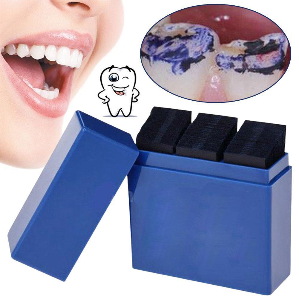 300 Sheets Dental Articulating - Teeth Whitening Retainer ulasan dan harga
