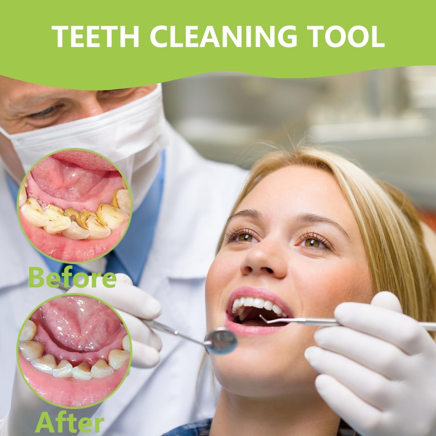 Professional Teeth Cleaning Or - Teeth Whitening Machine Professional ulasan dan harga
