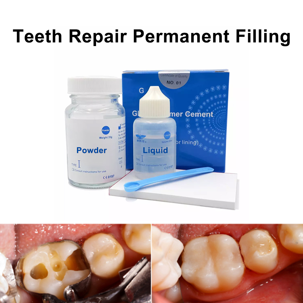 Permanent Teeth Filling Repair - Teeth Whitening Kit At Home ulasan dan harga