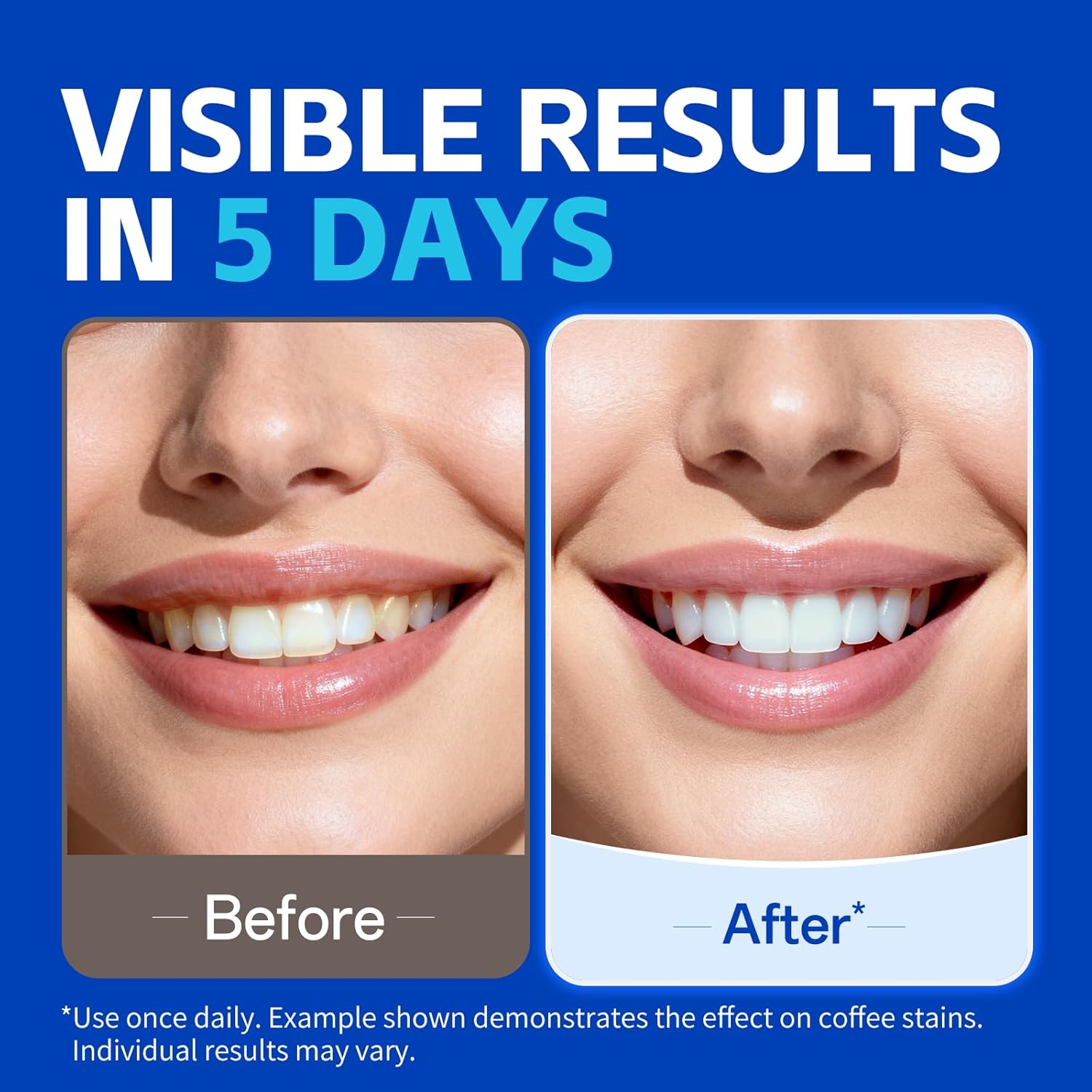 1/7 pairs Teeth Whitening Stri - Teeth Whitening Retainer ulasan dan harga