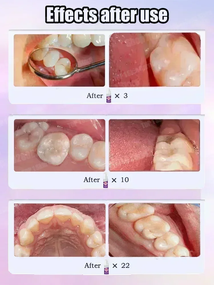 Hot sales Best-selling, Scient - Teeth Whitening Cream ulasan dan harga