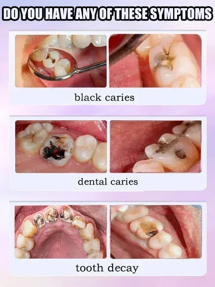 Hot sales Best-selling, Scient - Teeth Whitening Cream ulasan dan harga